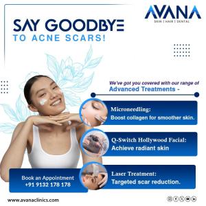 Best skin and hair clinic in Hyderabad